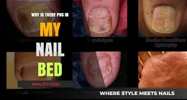 Pus in Nail Bed: Causes, Symptoms, and Effective Treatment Options