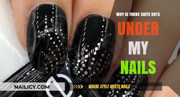 Shiny Dots Under Nails: Causes, Concerns, and Quick Solutions