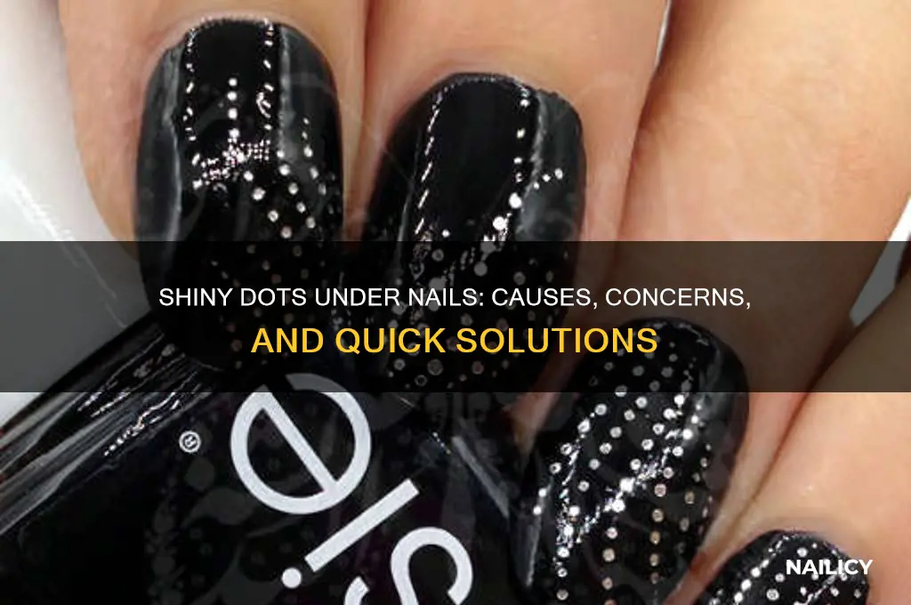 why is there shite dots under my nails