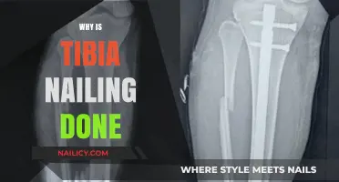 Understanding Tibia Nailing: Purpose, Procedure, and Patient Benefits Explained
