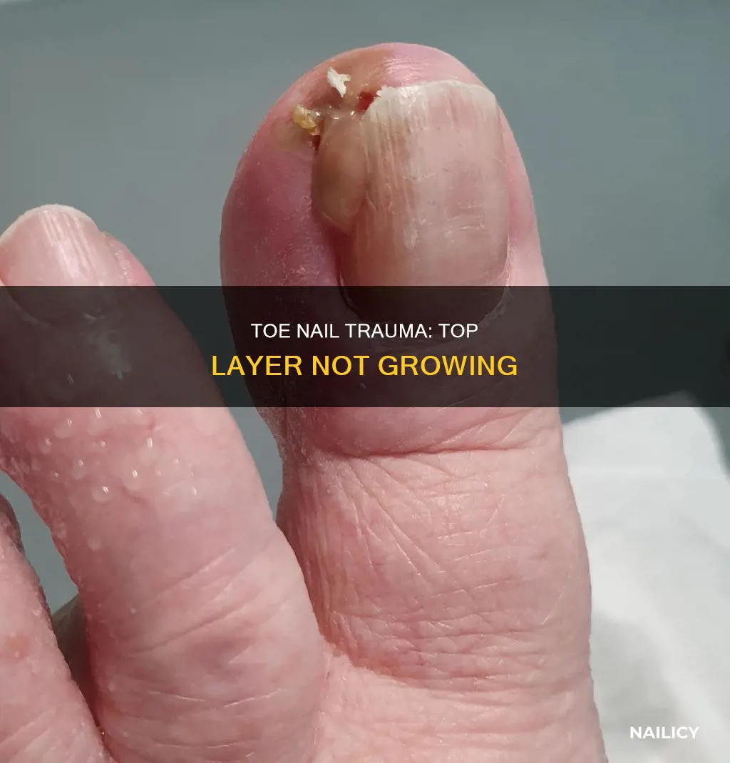 why is top layer toe nail not growing from base