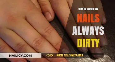 Why Do My Nails Always Look Dirty? Causes and Solutions
