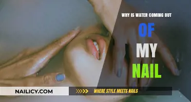 Water Under Nail: Causes, Concerns, and Quick Remedies Explained