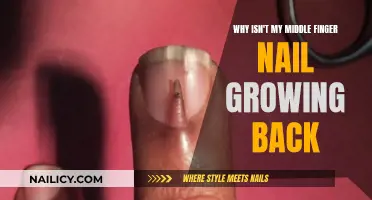 Middle Finger Nail Refuses to Grow Back: Why?