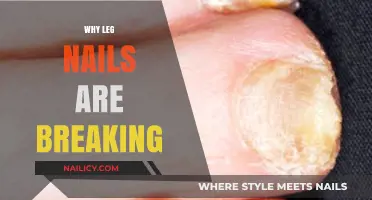 Why Are My Leg Nails Breaking? Causes and Solutions Explained