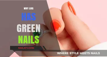 Why Luis Has Green Nails: Uncovering the Surprising Reason