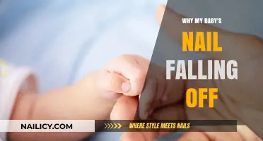Why Your Baby's Nail is Falling Off: Causes and Solutions