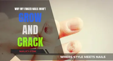 Nail Growth: Understanding Why Your Nails Crack and Fail to Grow