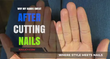 Sweaty Palms: Trimming Nails and Hyperhidrosis