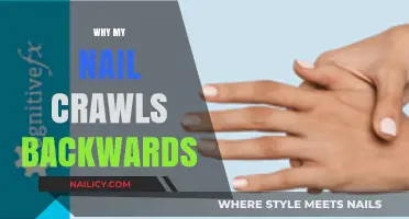 Why Do My Nails Crawl Backwards? Causes and Solutions Explained