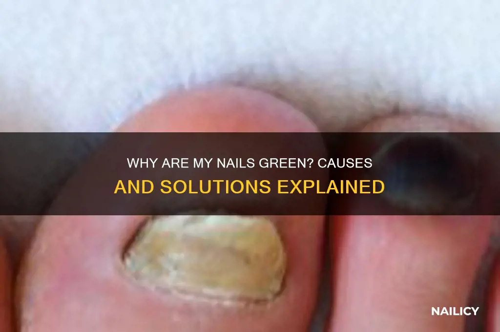 why my nail green