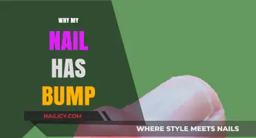 Understanding the Causes of Nail Bumps: A Comprehensive Guide