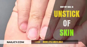 Why Your Nail Lifts: Causes and Solutions for Nail Separation