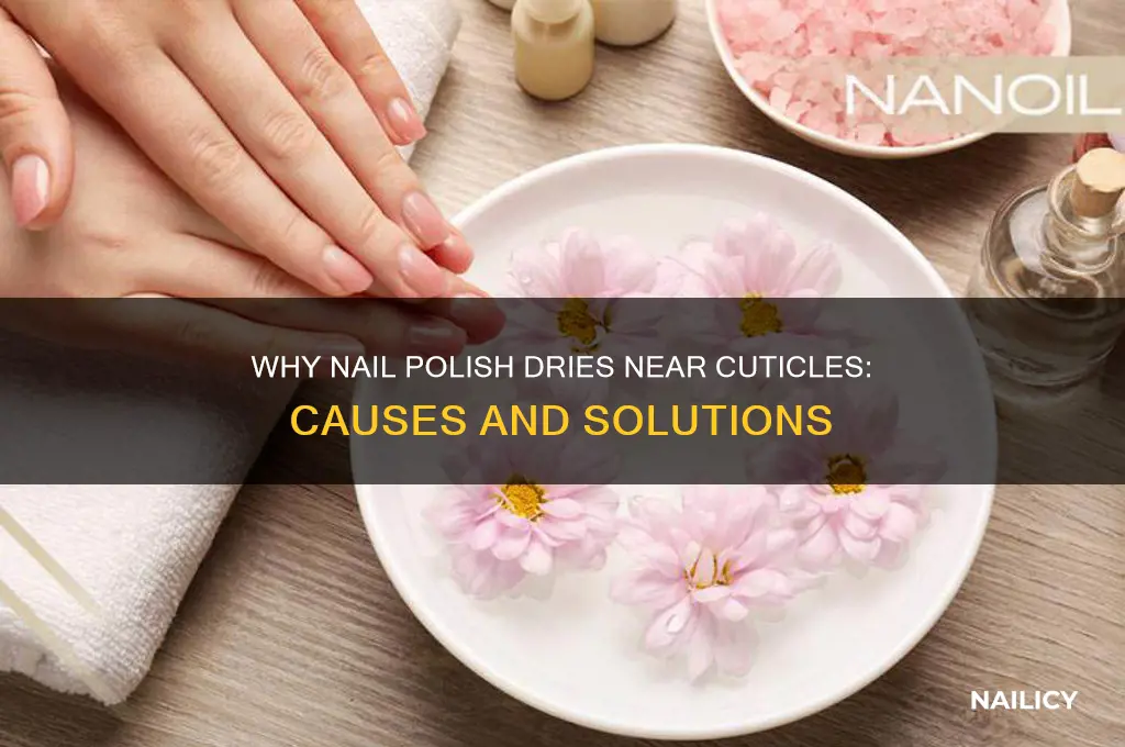 why my nail polish dries near cuticles