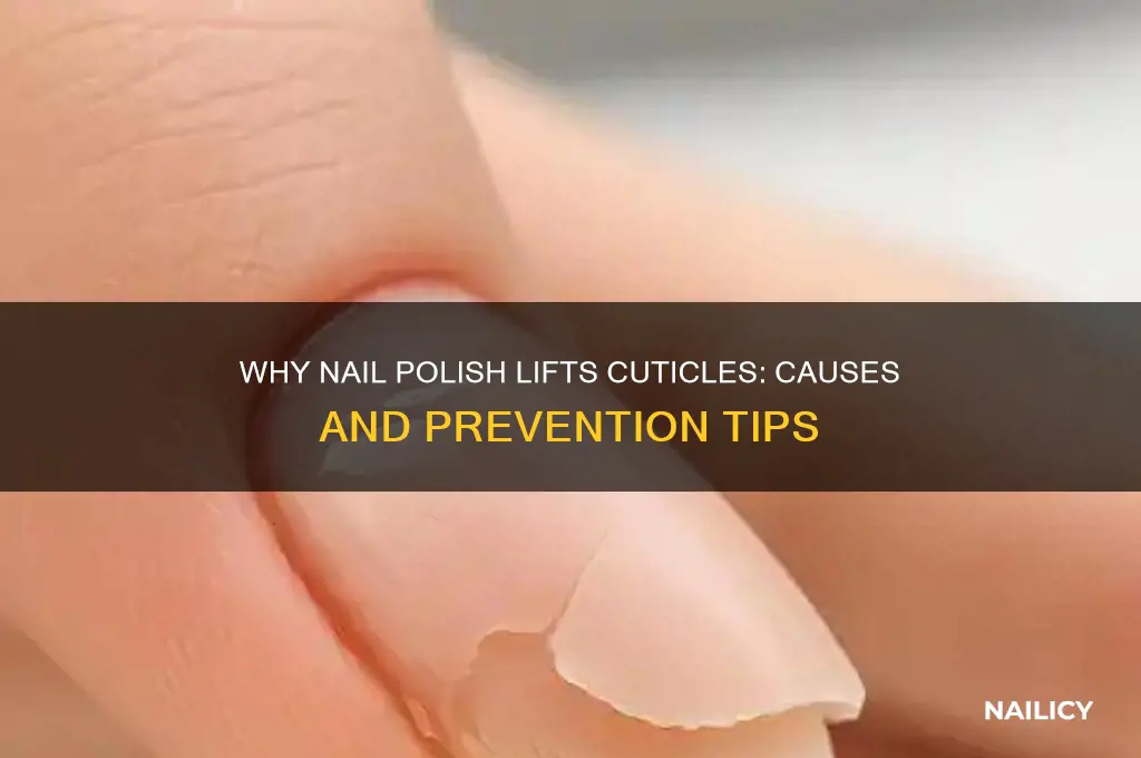 why my nail polish lifts cuticles