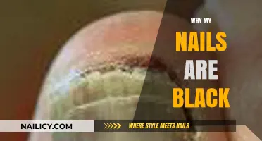 Why Are My Nails Black? Causes, Concerns, and Solutions Explained