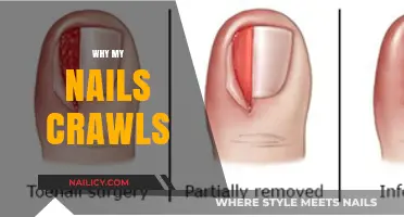 Why Do My Nails Crawl? Understanding the Causes and Solutions