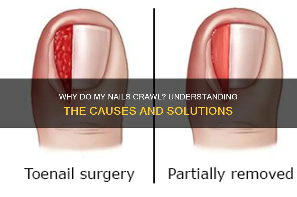 why my nails crawls