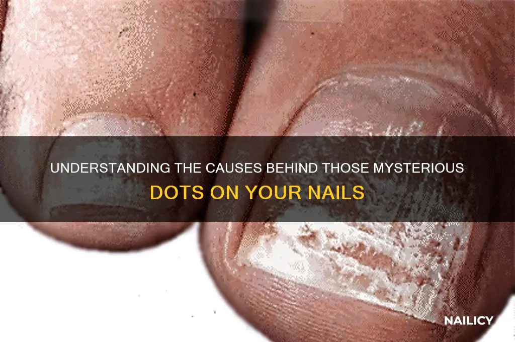 why my nails have dots