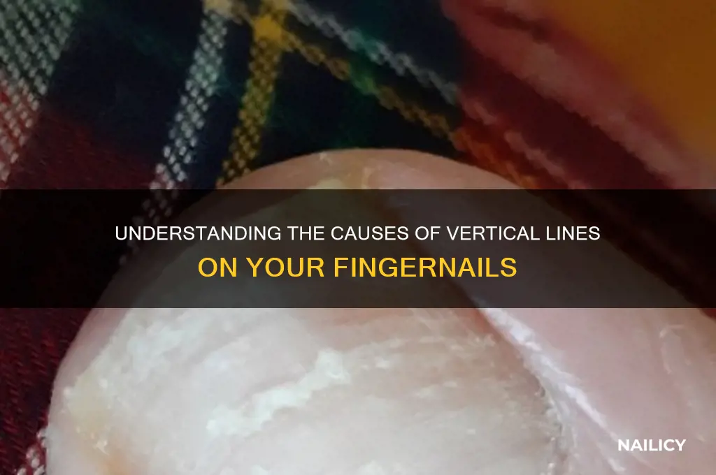 why my nails have lines