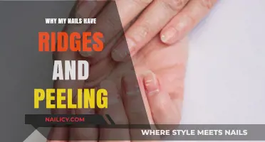 Ridges and Peeling Nails: Causes, Concerns, and Effective Solutions