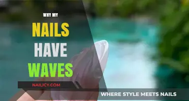Why Do My Nails Have Waves? Causes and Solutions Explained