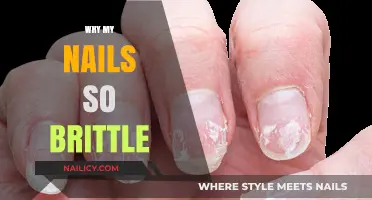 Why Are My Nails So Brittle? Causes and Solutions Explained