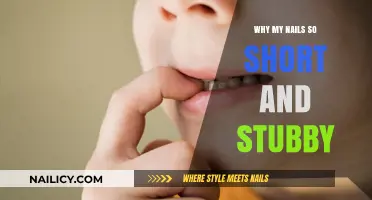 Stubby Nails Explained: Causes and Solutions for Short Nails