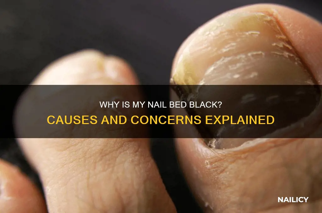 why nail bed is black