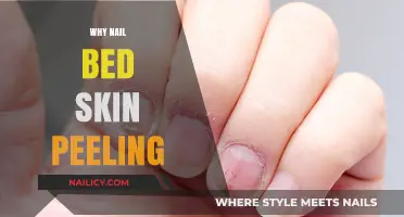 Why Is My Nail Bed Skin Peeling? Causes and Solutions
