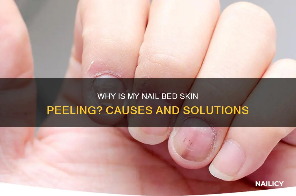 why nail bed skin peeling