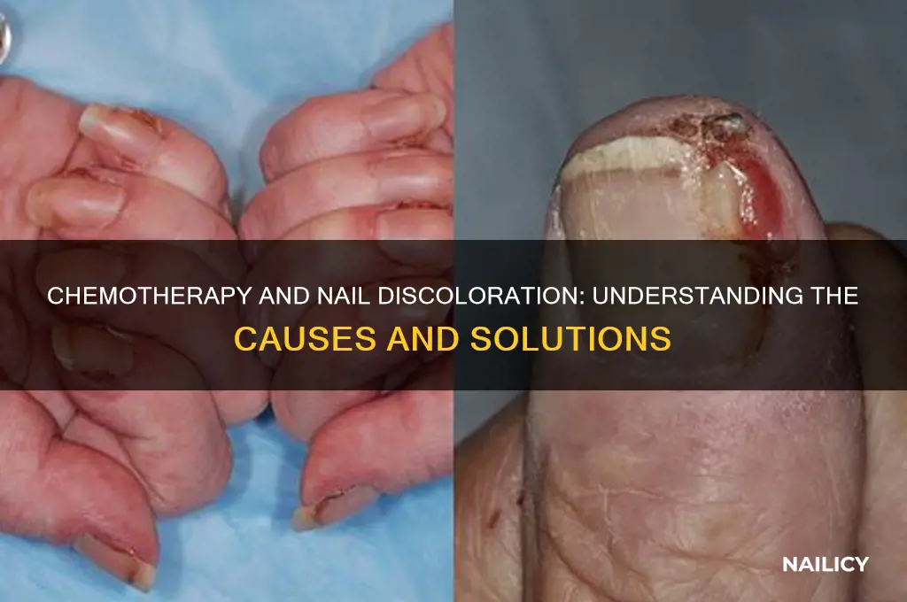 why nail discolored chemo