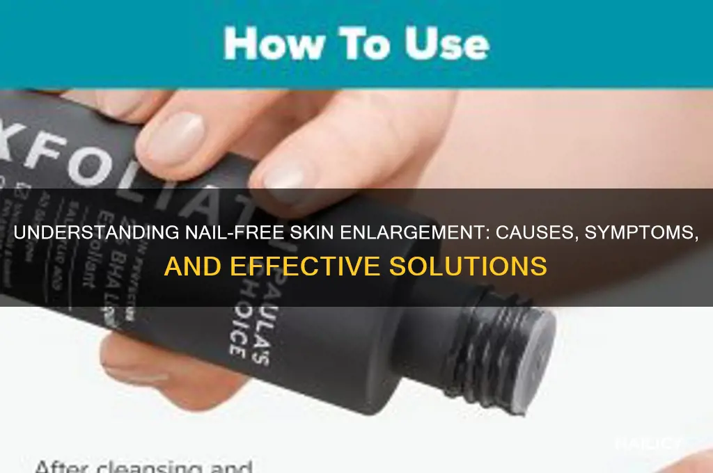 why nail free skin enlarged