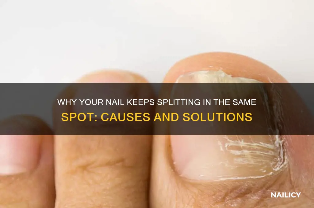 why nail keeps splitting in same spot