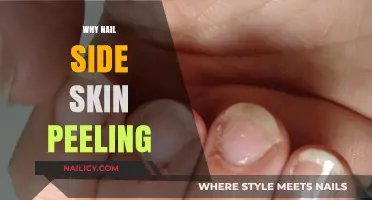 Why Does Nail Side Skin Peel? Causes and Solutions Explained