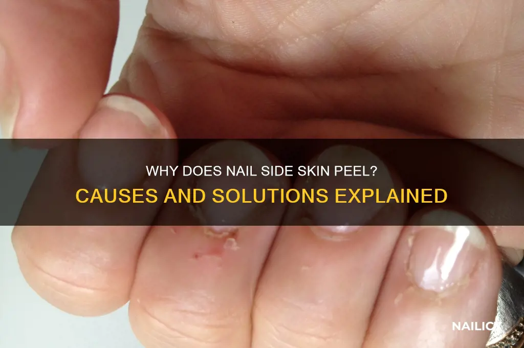why nail side skin peeling
