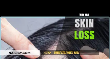 Understanding Nail Skin Loss: Causes, Prevention, and Effective Treatments
