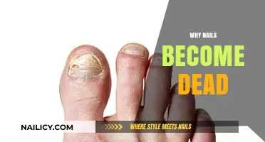 Understanding Dead Nails: Causes, Prevention, and Treatment Options