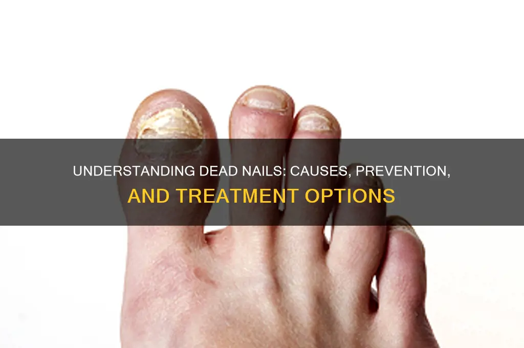 why nails become dead
