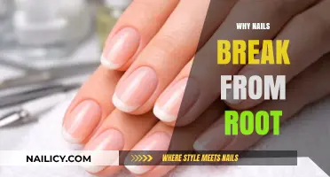 Why Nails Break from the Root: Causes and Prevention Tips