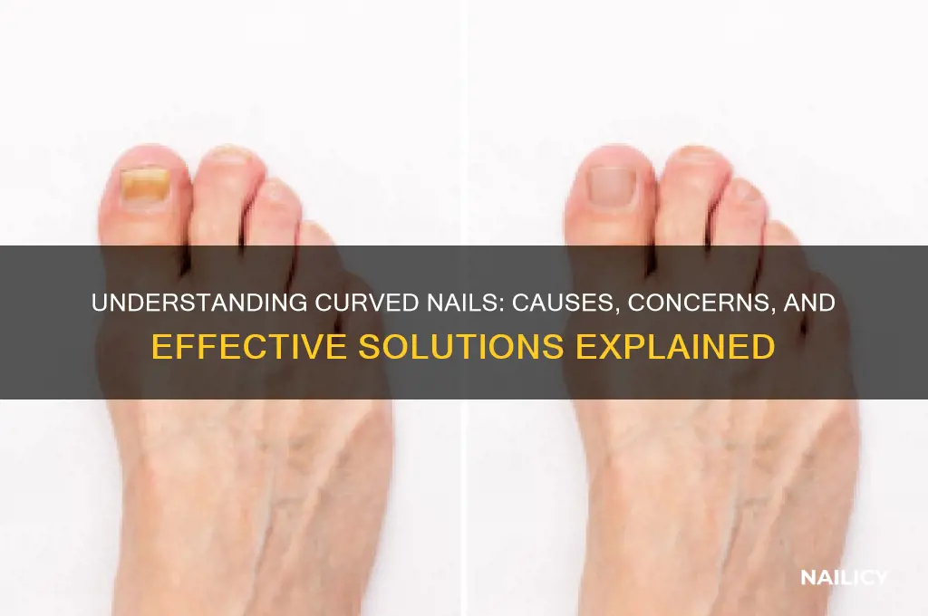 why nails curve down
