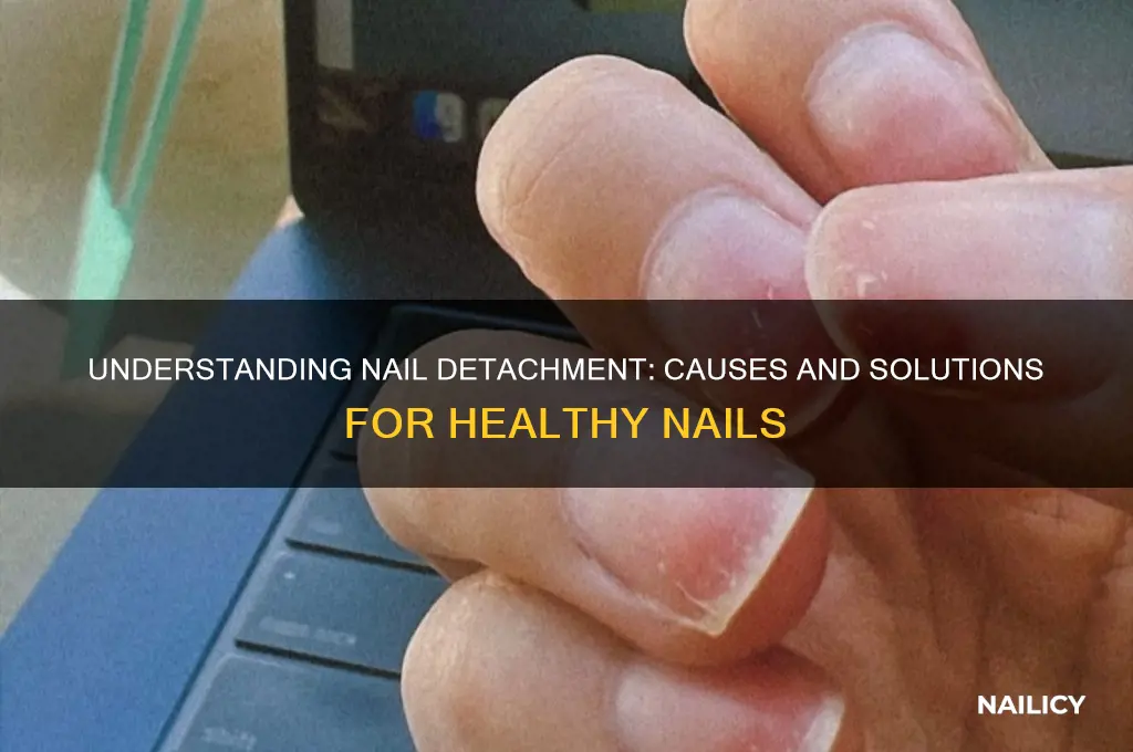 why nails detached from skin