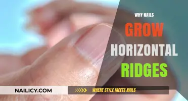 How Ridges on Nails Indicate Health Issues