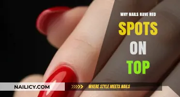 Red Spots on Nails: Causes, Concerns, and When to Seek Help