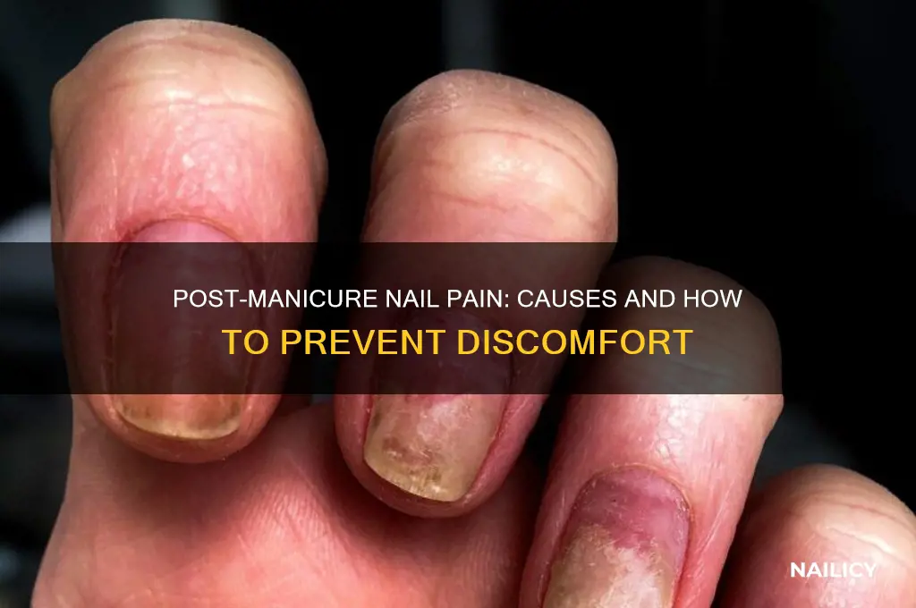 why nails hurt after manicure