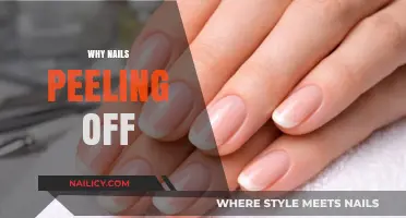 Why Are My Nails Peeling? Causes and Solutions for Brittle Nails