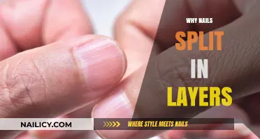 Why Do Nails Split in Layers? Causes and Solutions Explained