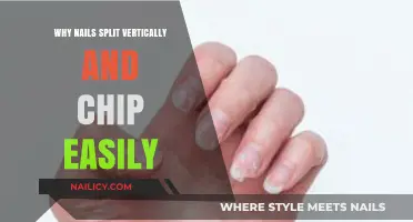 Why Nails Split Vertically and Chip Easily: Causes and Solutions