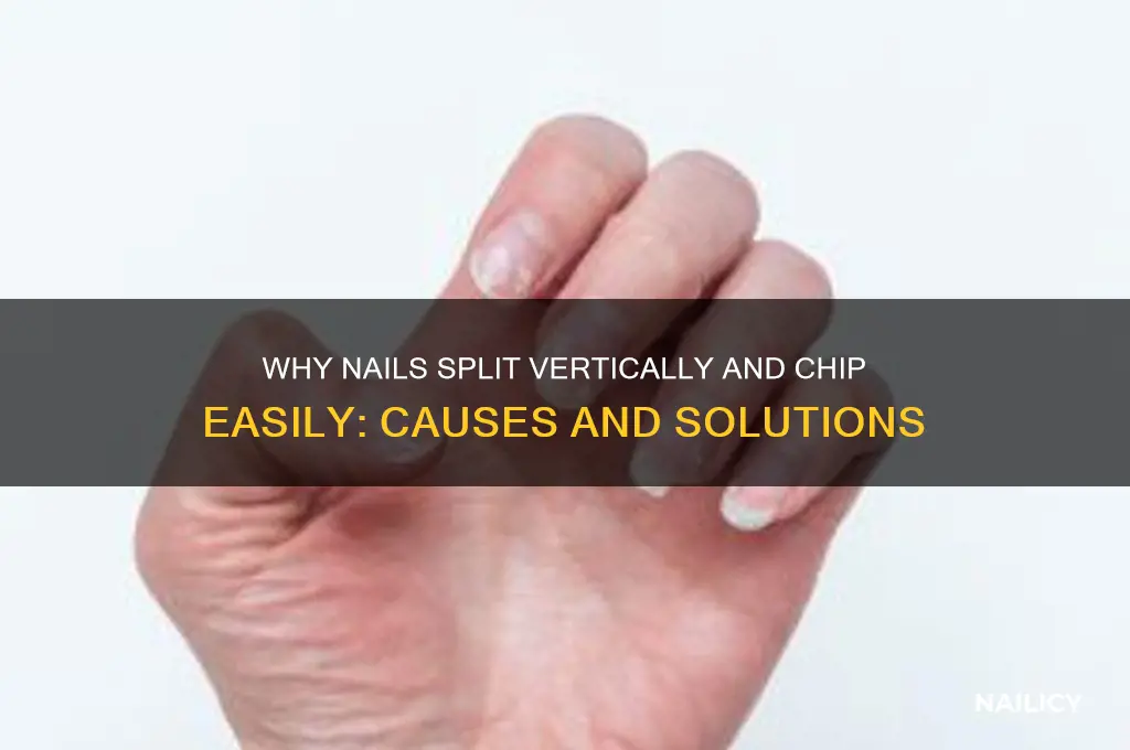 why nails split vertically and chip easily