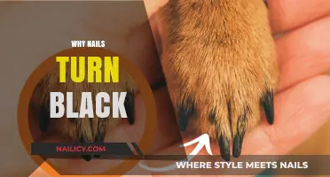 Why Nails Turn Black: Causes, Concerns, and Treatment Options
